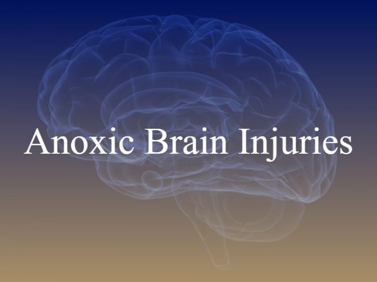 What Is An Anoxic Brain Injury?