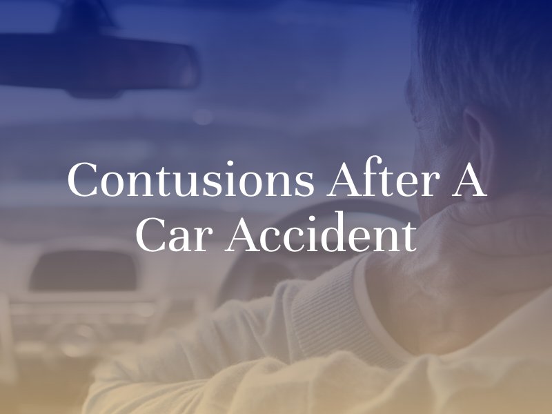 contusions after a car accident